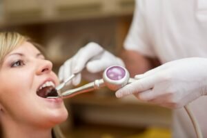 Composite Bonding